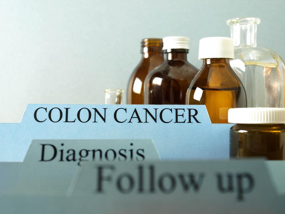 Colon Cancer &#8211; Its Stages III and IV