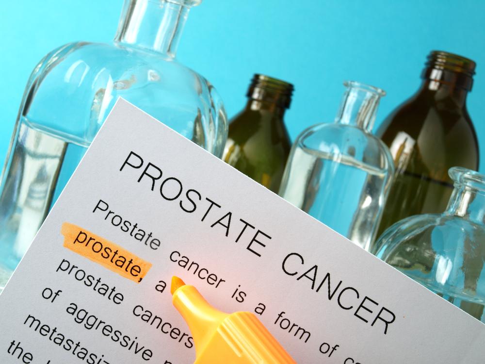 Prostate Cancer – Prevention, Treatment, and Risk Factors